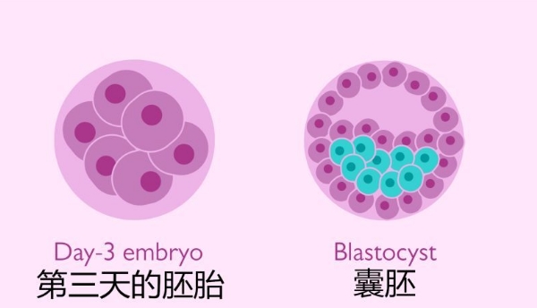 女子代孕