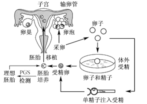 代孕