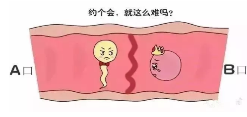 代孕