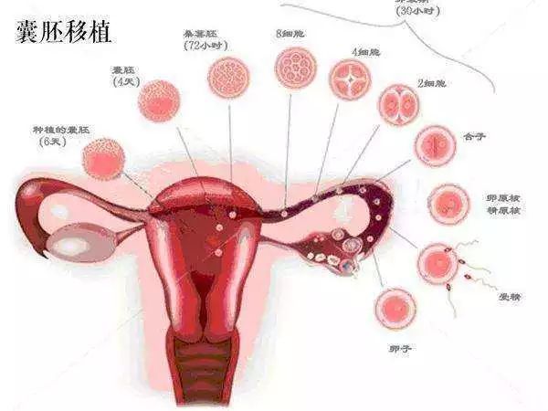 代孕