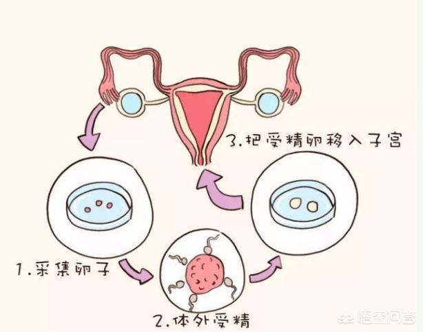 代孕政策